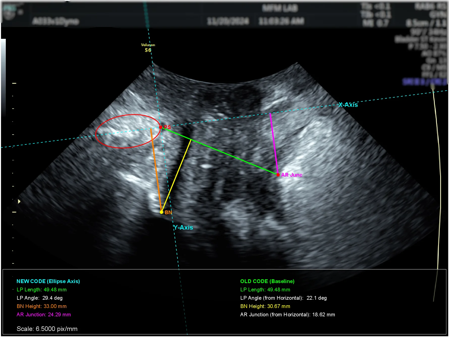 Ultrasound Imaging (USI) Biometric Analysis