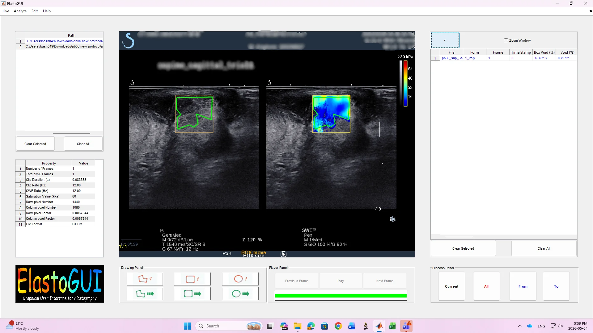 ElastoGUI: Quantitative SWE Elastography Analysis