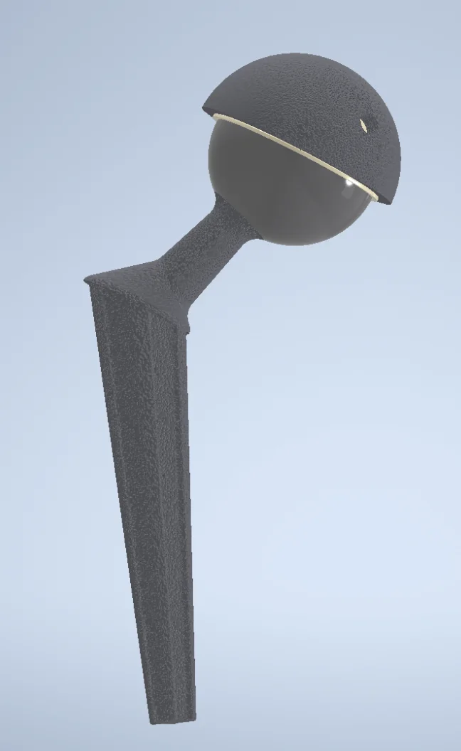 Custom Hip Implant