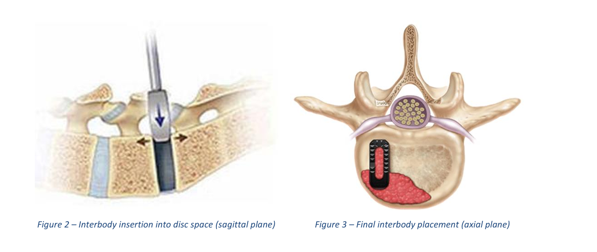 project-highlight-image